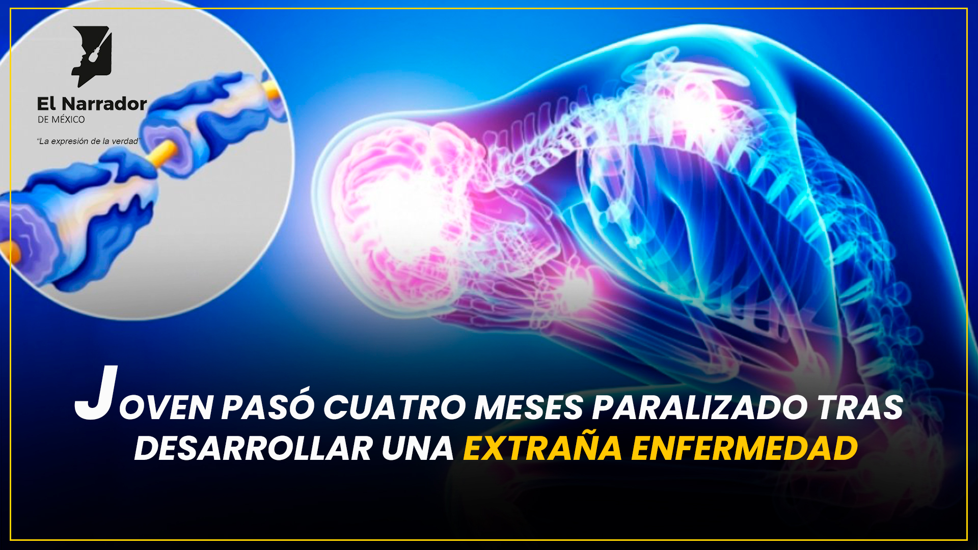 JOVEN QUEDA PARALIZADO CUATRO MESES POR EXTRAÑA ENFERMEDAD
