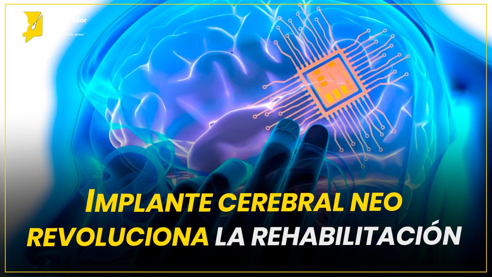 IMPLANTE CEREBRAL NEO REVOLUCIONA LA REHABILITACIÓN